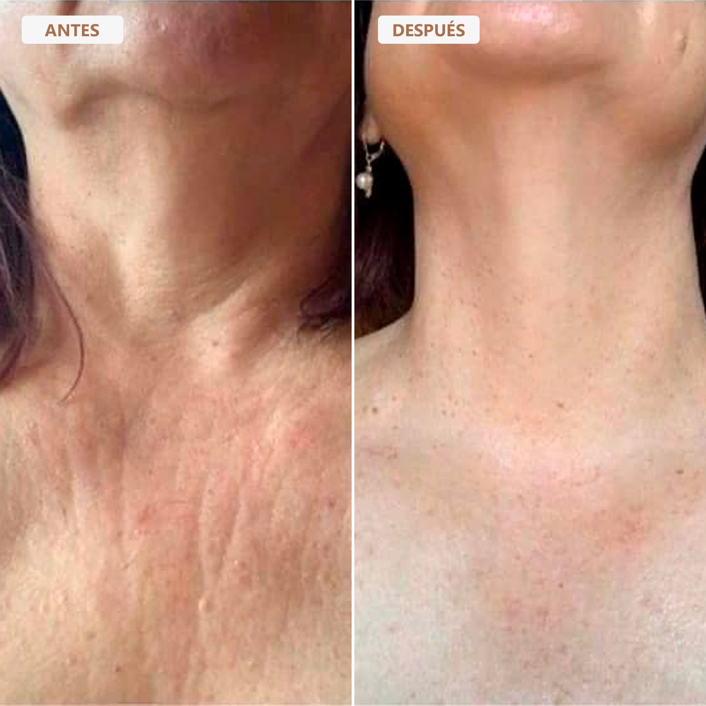 Aceite Corporal Besque™