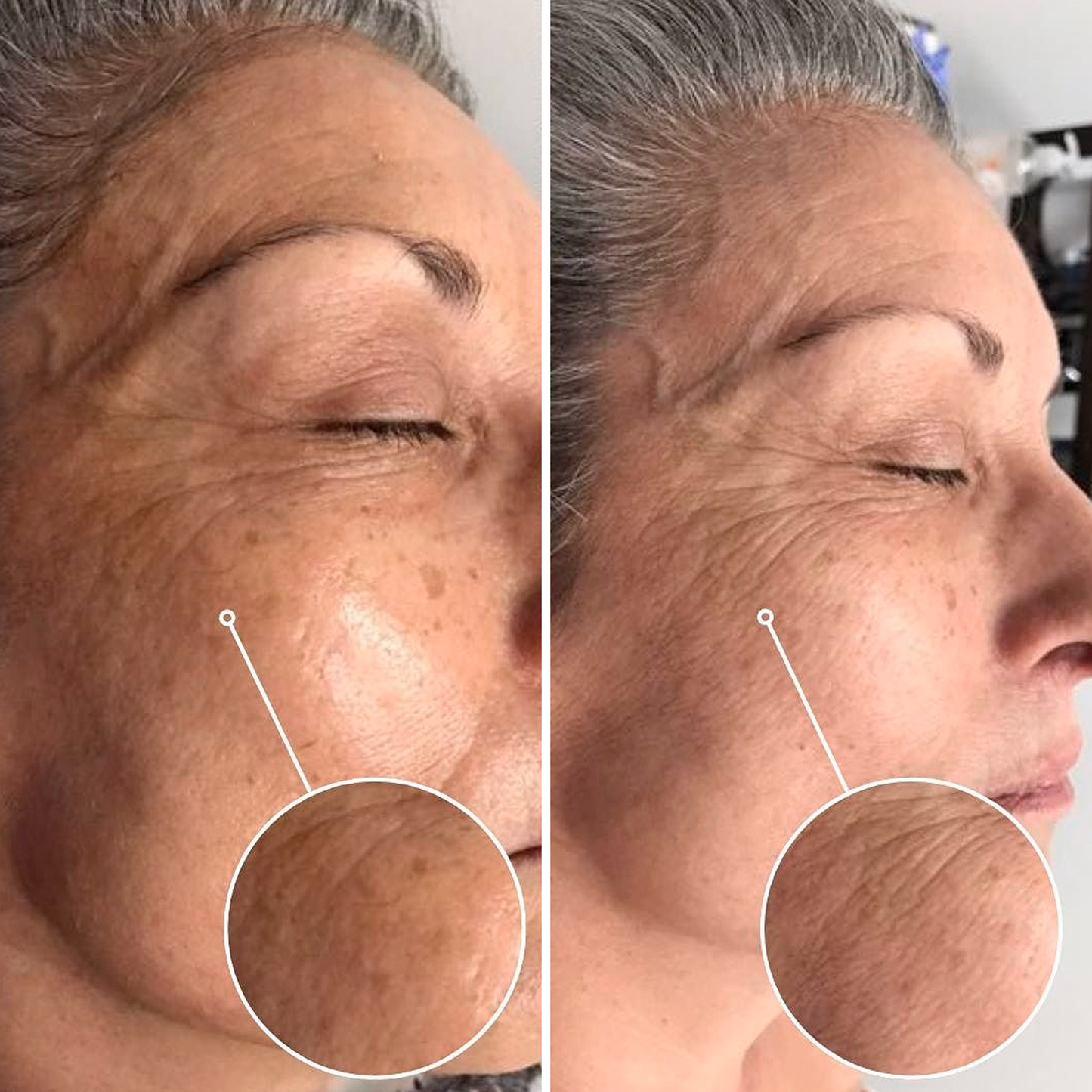 JIYU | PADS COREANOS ACLARA AXILAS