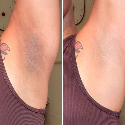 JIYU | PADS COREANOS ACLARA AXILAS