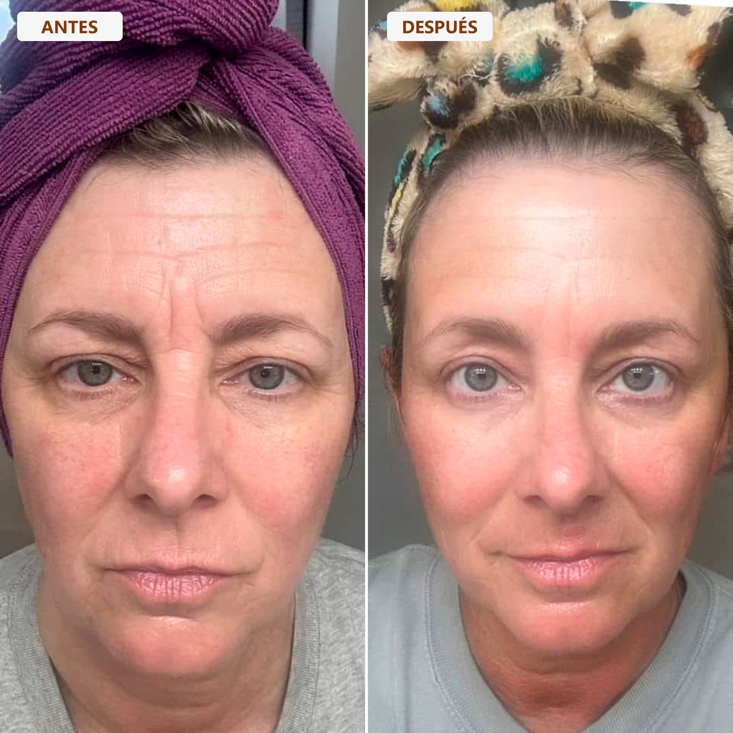 Brocha Facial para Contorno Linfático