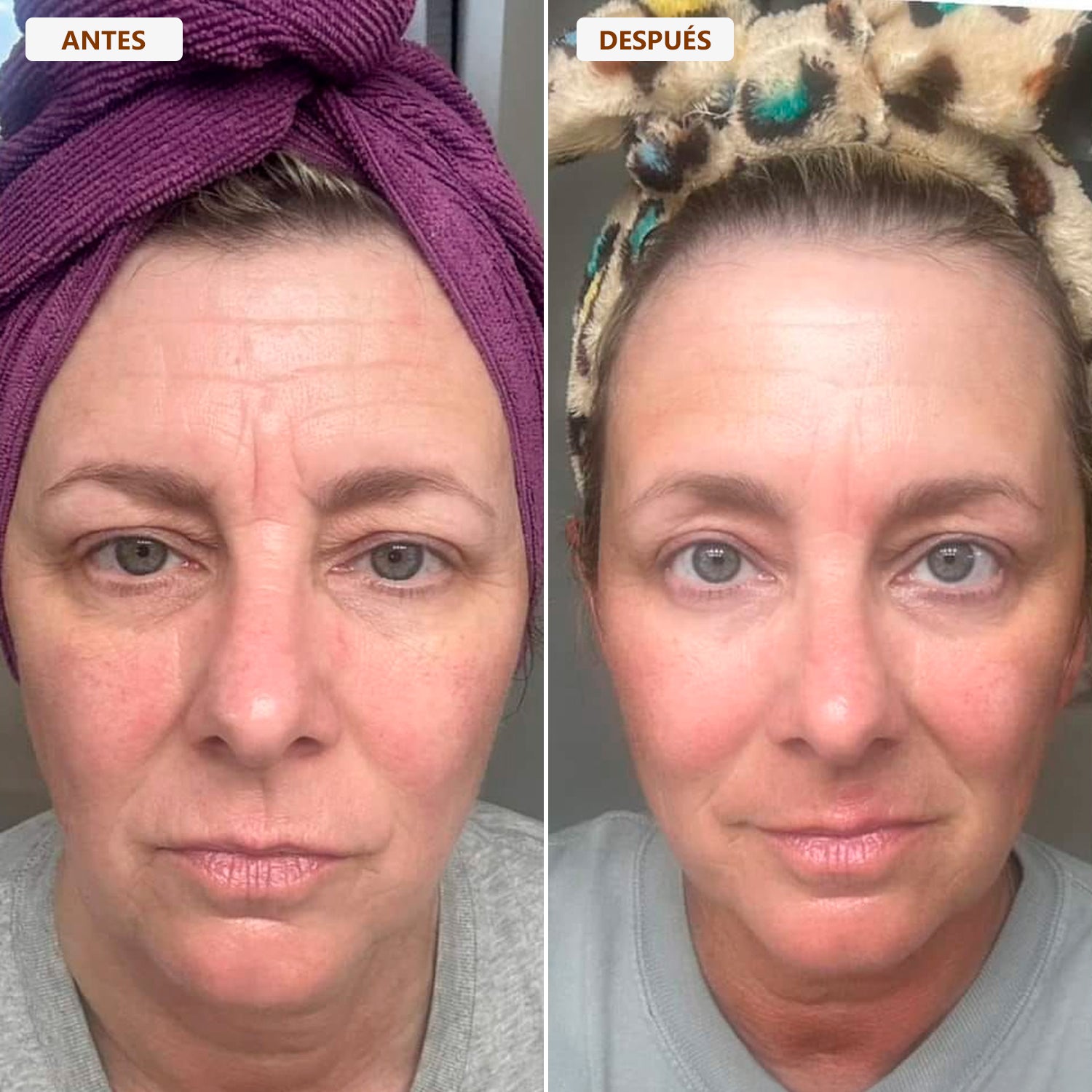 Brocha Facial para Contorno Linfático
