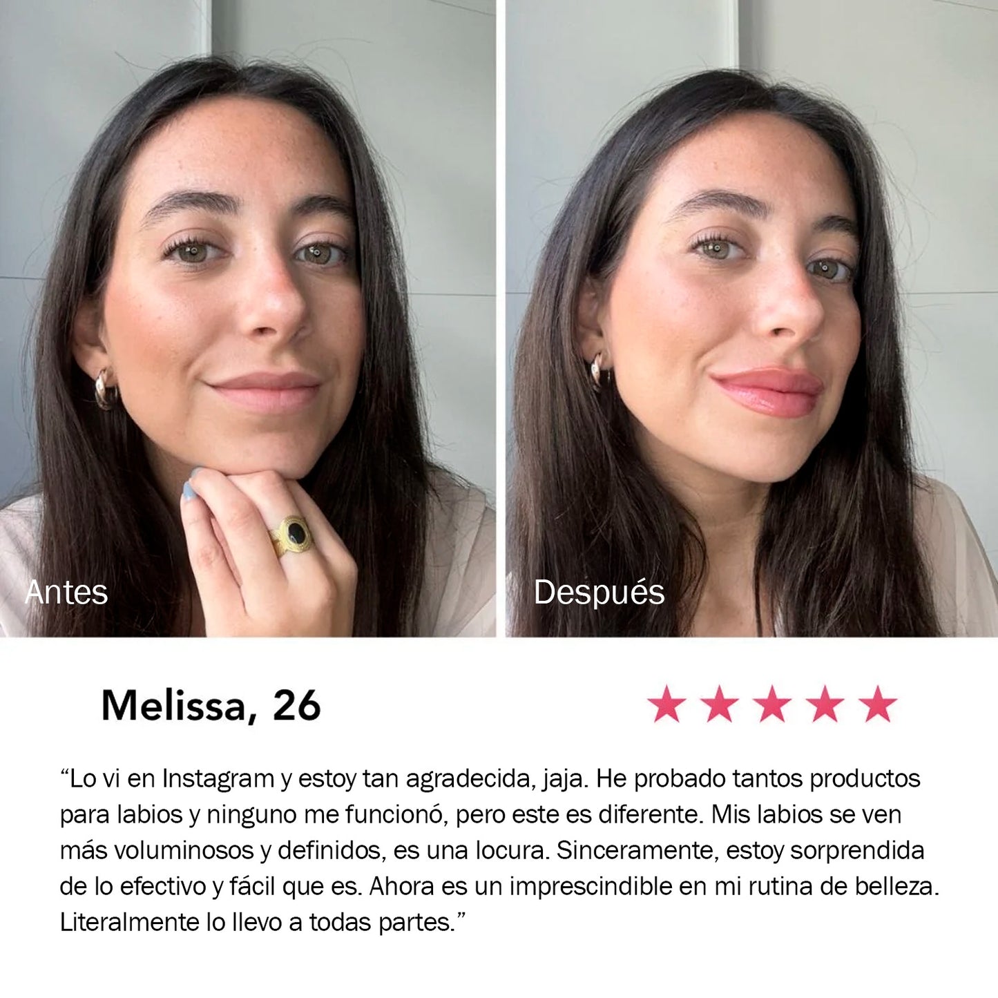 Kora Lip | Gloss Voluminizador