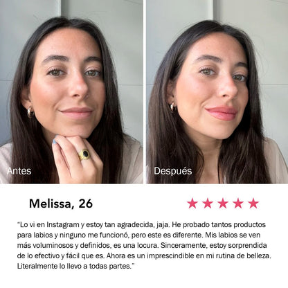 Kora Lip | Gloss Voluminizador