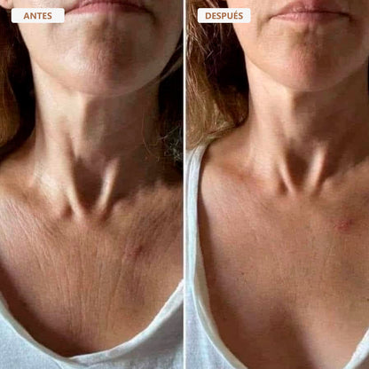 Aceite Corporal Besque™