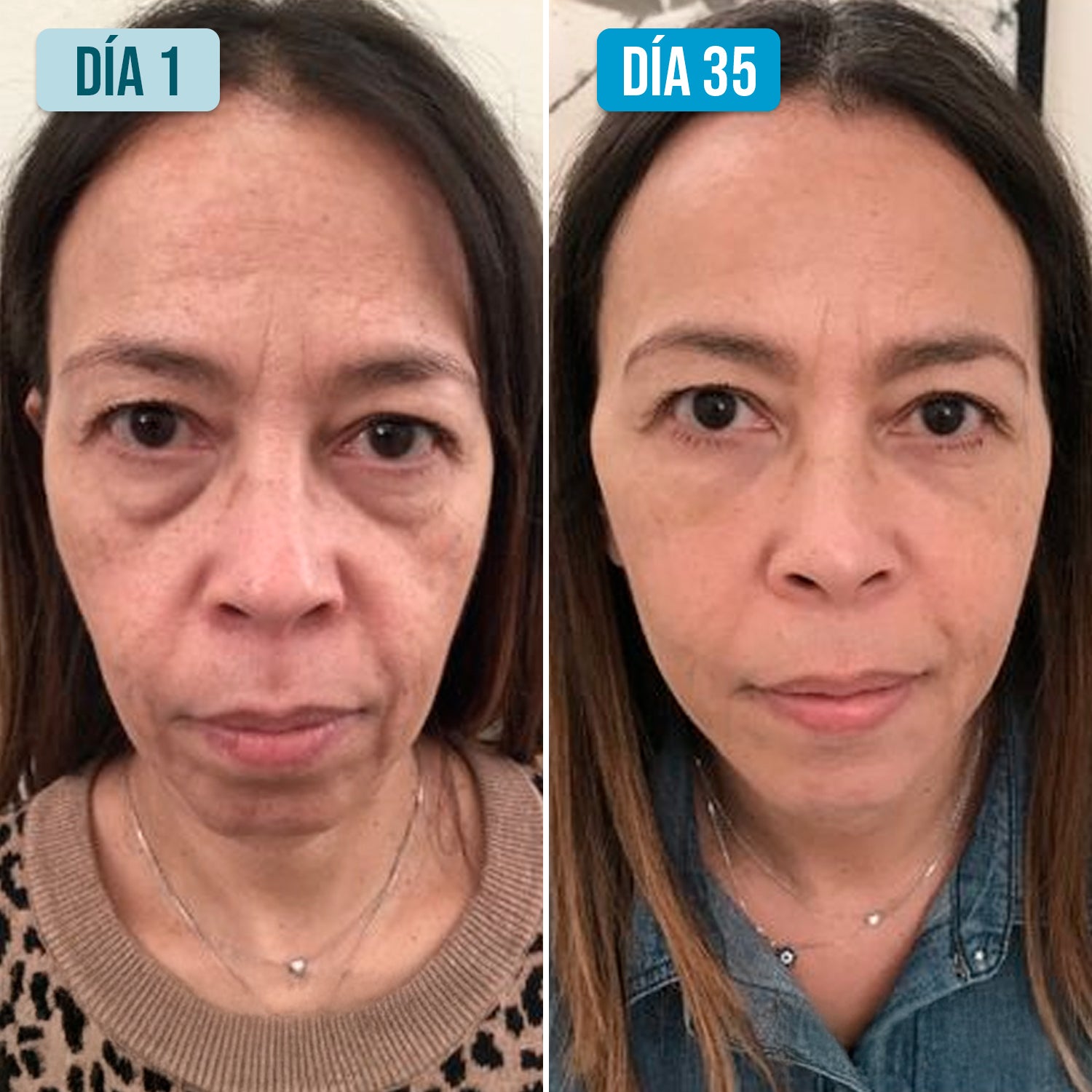 Serum Ultra Hidratante-Reparador con 3% de Ácido Hialurónico