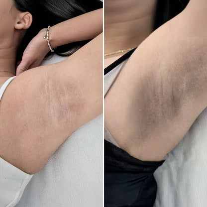 JIYU | PADS COREANOS ACLARA AXILAS