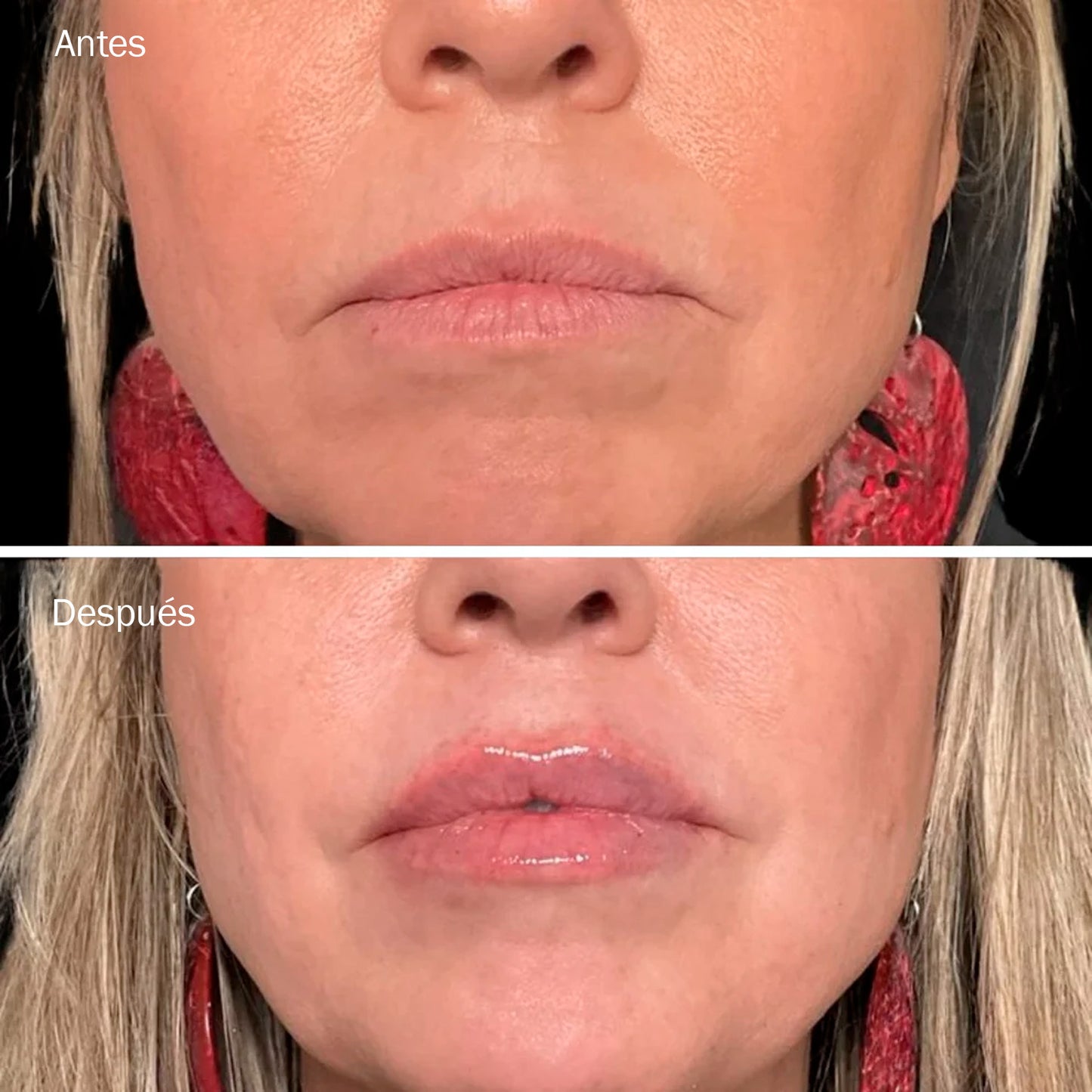 Kora Lip | Gloss Voluminizador