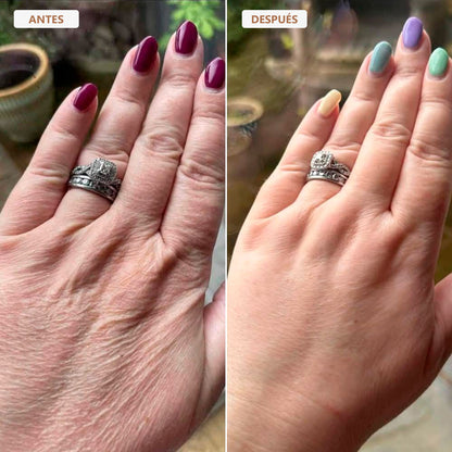 Aceite Corporal Besque™