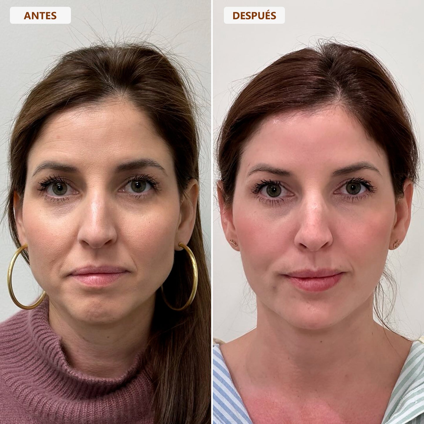 Brocha Facial para Contorno Linfático