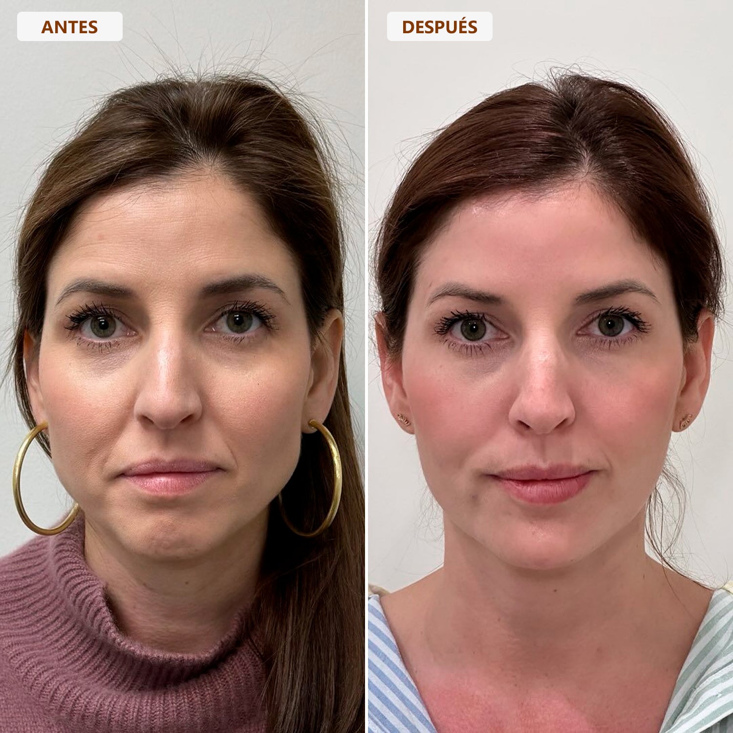 Brocha Facial para Contorno Linfático