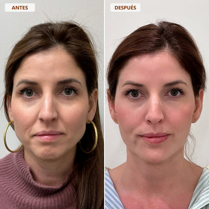 Brocha Facial para Contorno Linfático