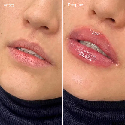 Kora Lip | Gloss Voluminizador