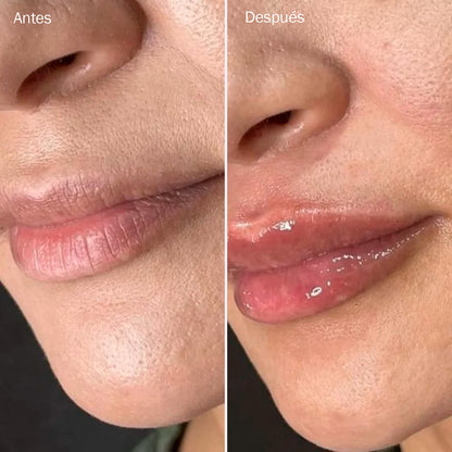Kora Lip | Gloss Voluminizador