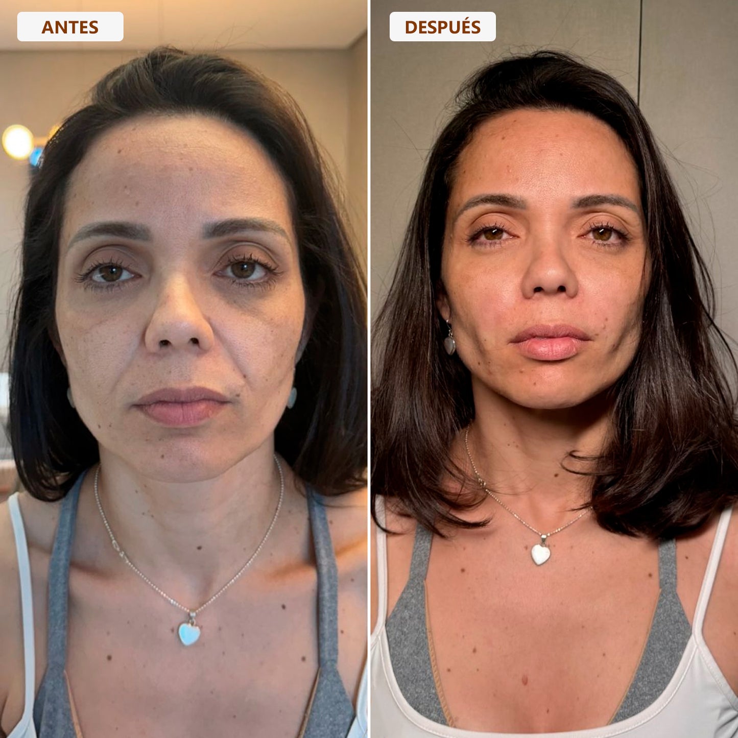 Brocha Facial para Contorno Linfático