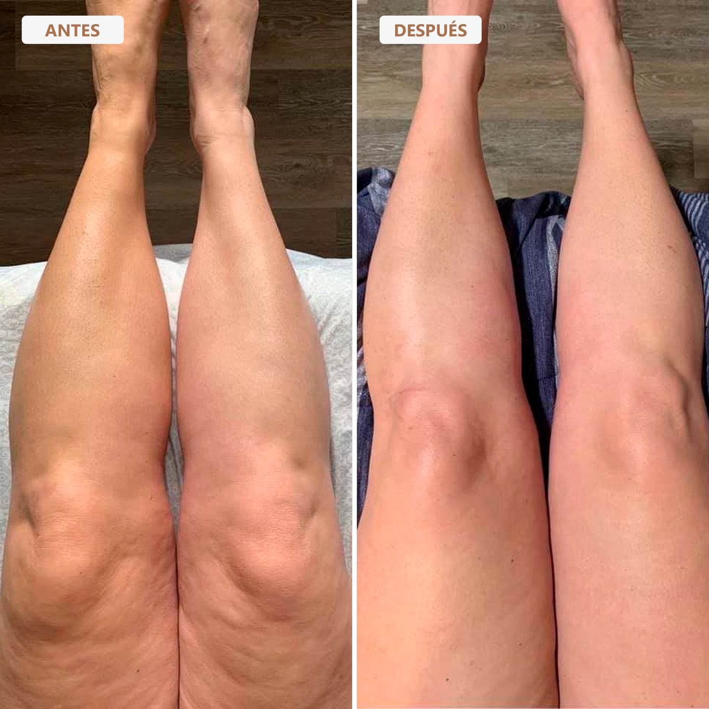 Aceite Corporal Besque™