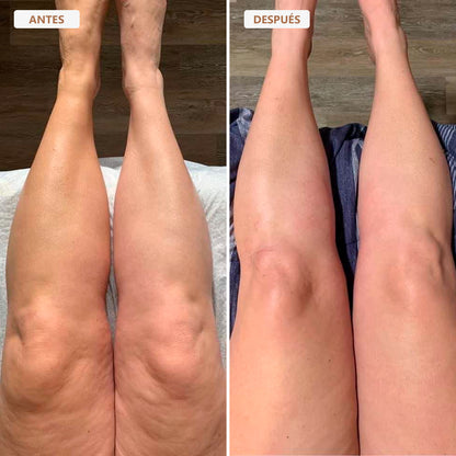 Aceite Corporal Besque™