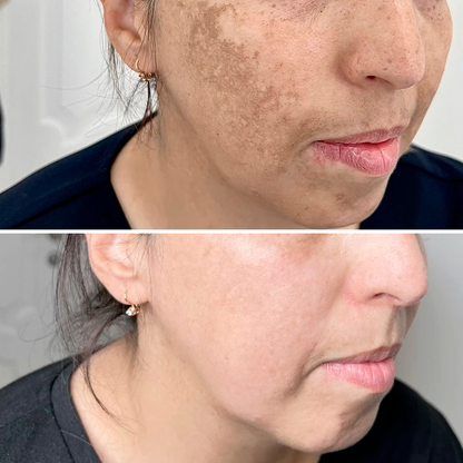 JIYU | PADS COREANOS ACLARA AXILAS